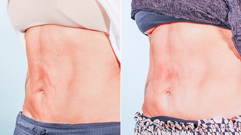 attiva-abdomen